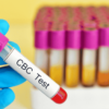 cbc test