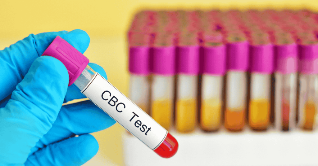 cbc test