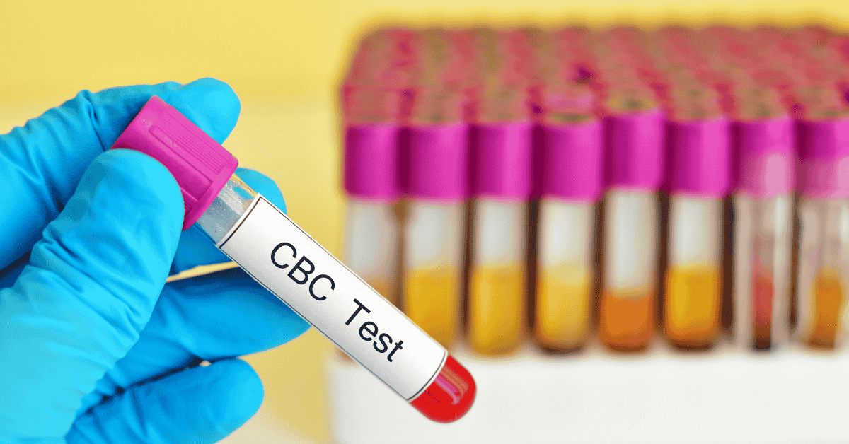 cbc test