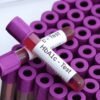 hbA1c test