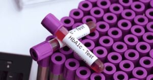 hbA1c test