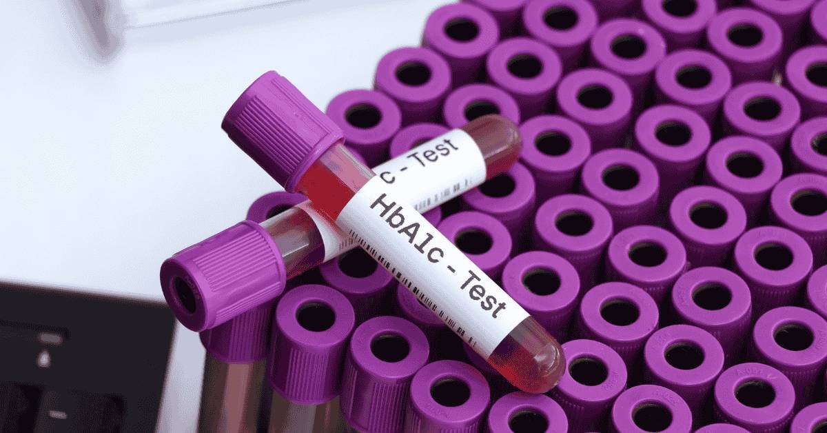 hbA1c test