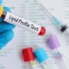 lipid profile test