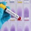 liver function test