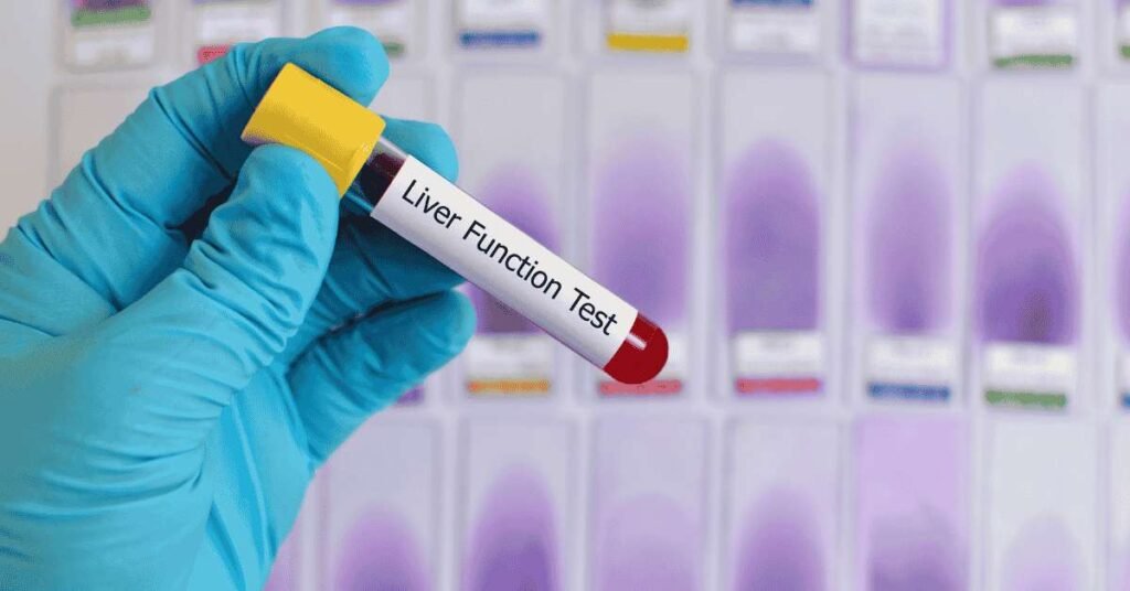 liver function test