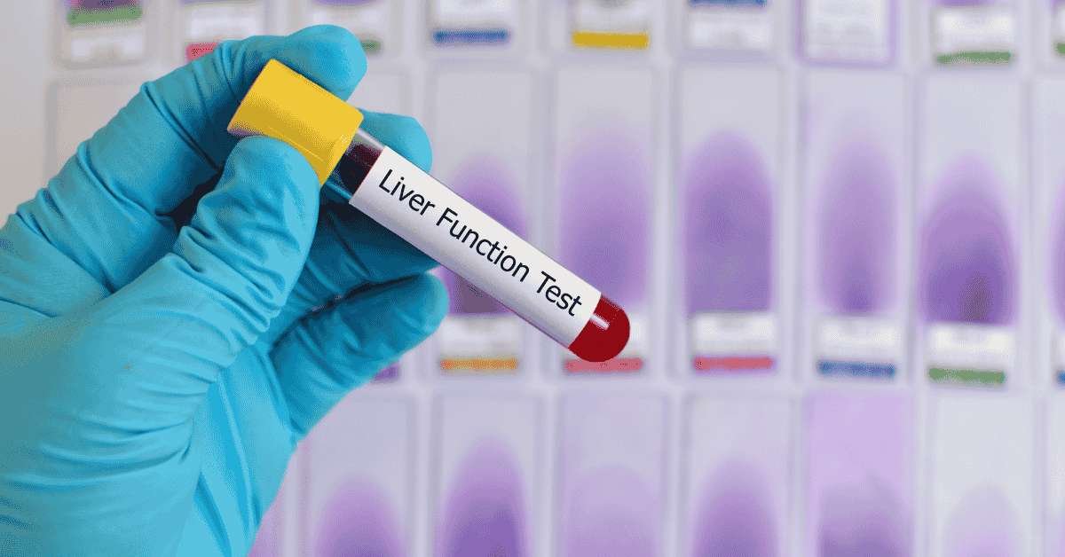 liver function test