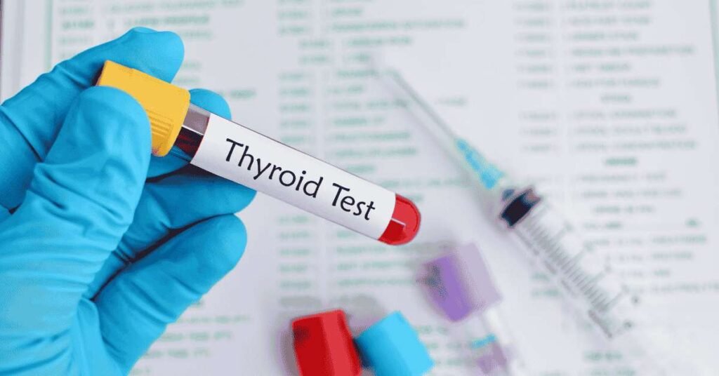 thyroid test