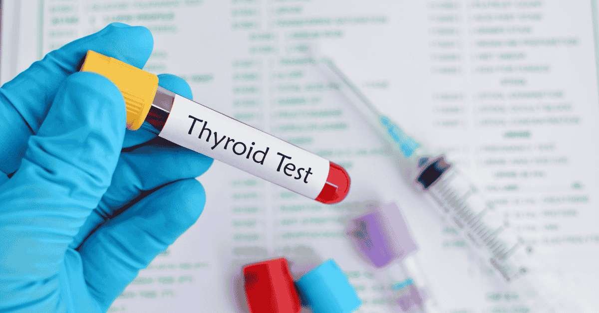 thyroid test