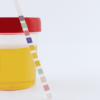 urine test