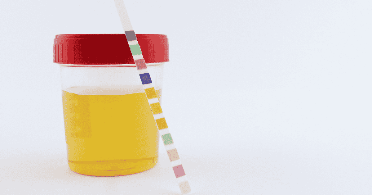 urine test