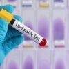 lipid profile test
