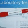 liver function test