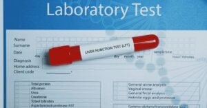 liver function test
