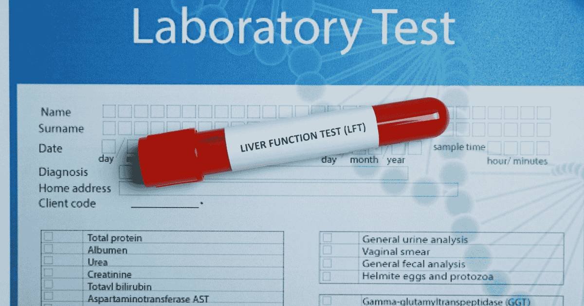 liver function test