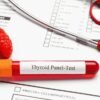 thyroid test