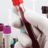 Blood Test