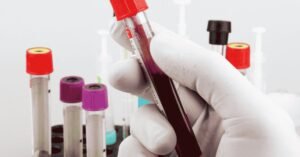 Blood Test