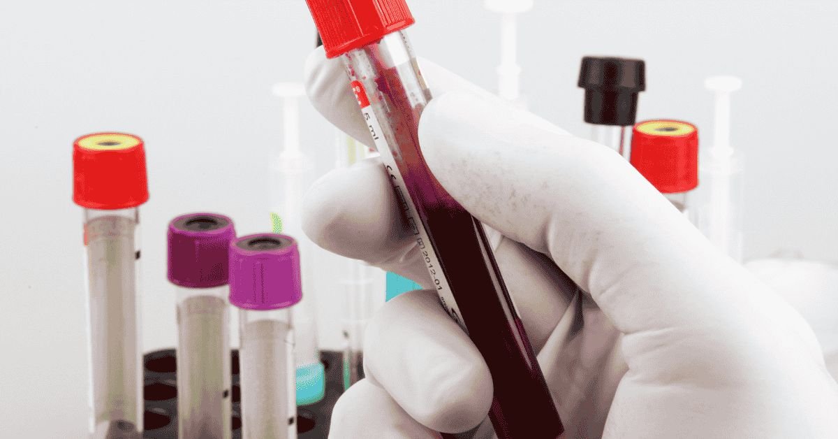 Blood Test