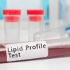 Lipid Profile Test