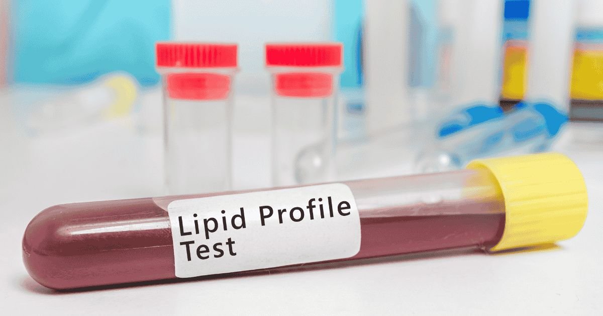 Lipid Profile Test
