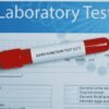 Liver Function Test