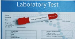 Liver Function Test