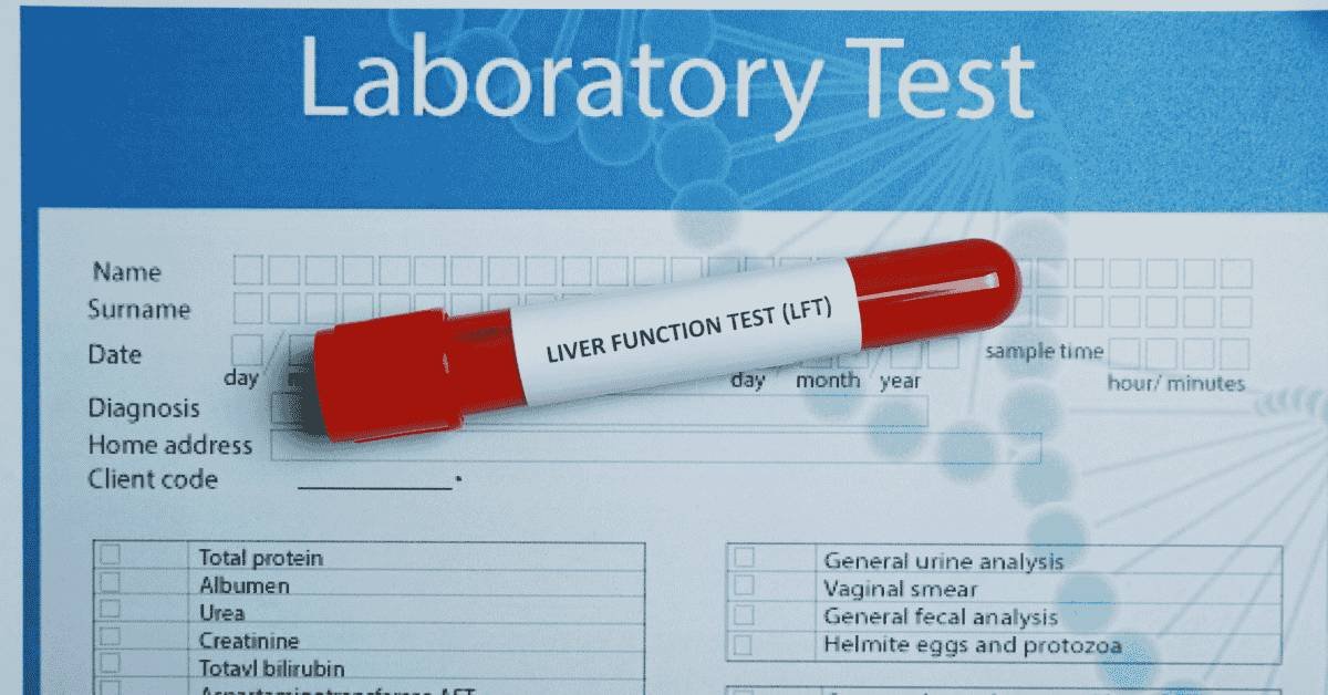 Liver Function Test