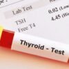 Thyroid Test