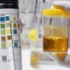 Urine Test