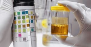 Urine Test