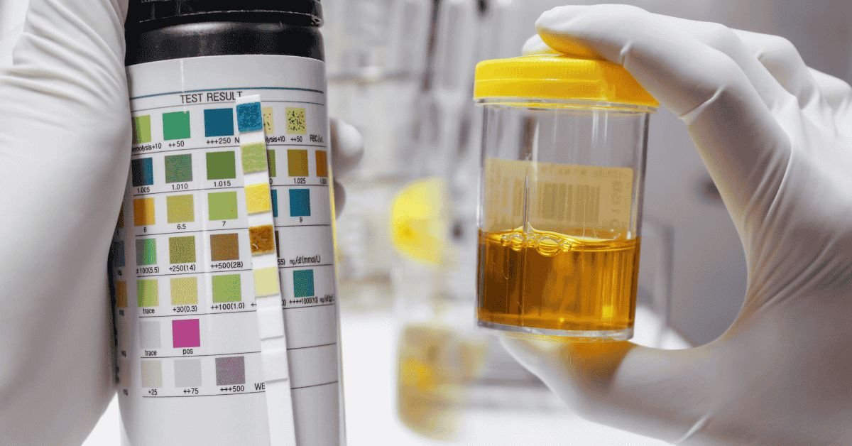 Urine Test