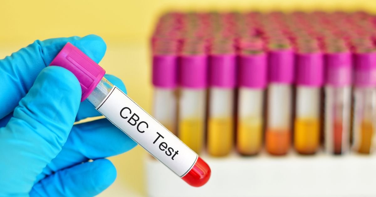 Complete Blood Count (CBC): Purpose, Process, and Normal Range