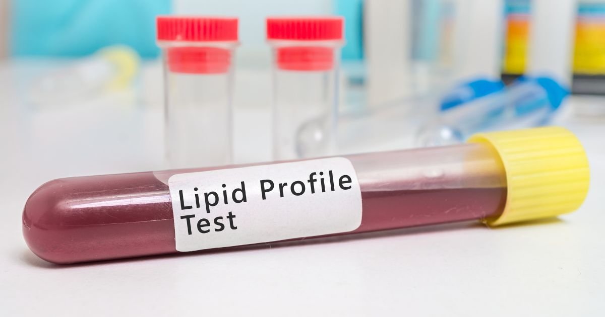 Lipid Profile Test: Understanding Good vs Bad Cholesterol