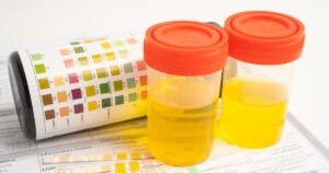 Liver and Kidney Function Tests Explained