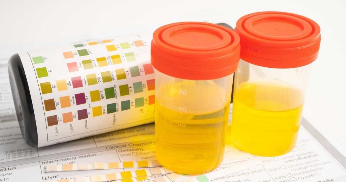 Liver and Kidney Function Tests Explained