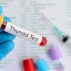 Thyroid Test (T3, T4, TSH): When and Why You Need It