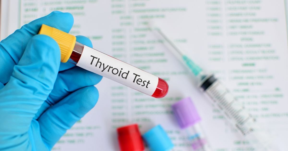 Thyroid Test (T3, T4, TSH): When and Why You Need It