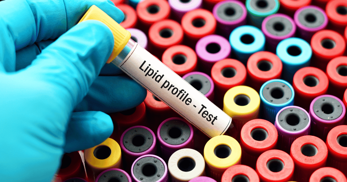 Lipid Profile Test: A Simple Guide to Understanding Your Cholesterol Levels