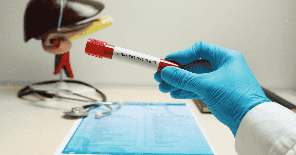Liver Function Test: Understanding Your Liver Health and Why Testing Matters