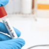 Vitamin D Test Why Checking Your Vitamin D Levels Is Important for Your Health