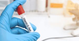 Vitamin D Test Why Checking Your Vitamin D Levels Is Important for Your Health