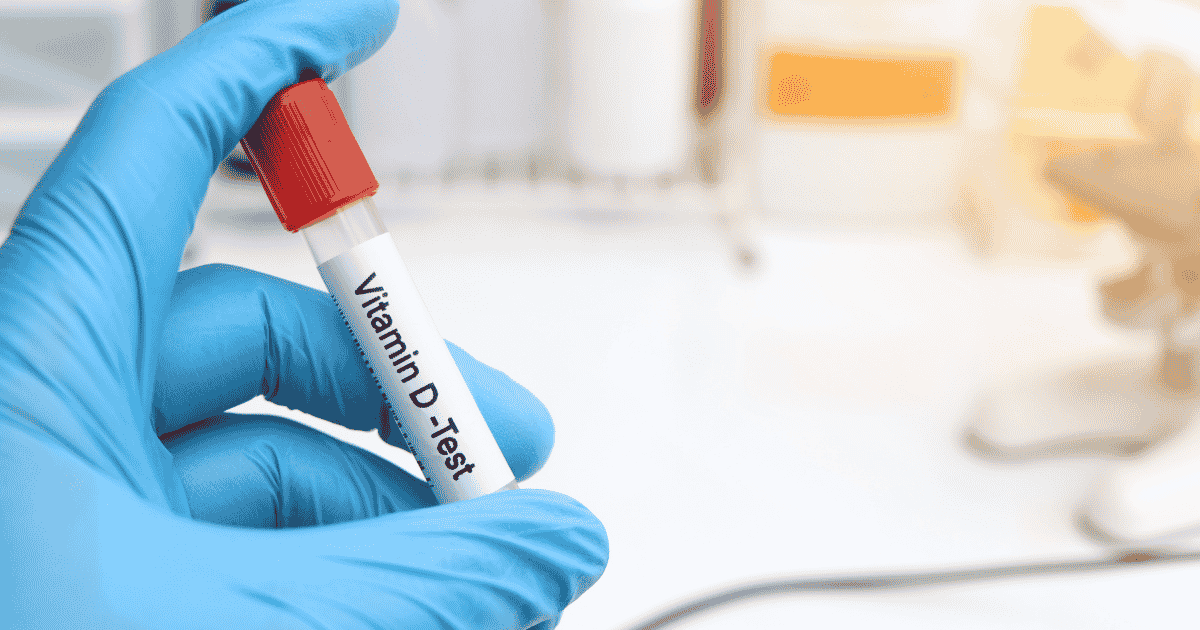 Vitamin D Test Why Checking Your Vitamin D Levels Is Important for Your Health