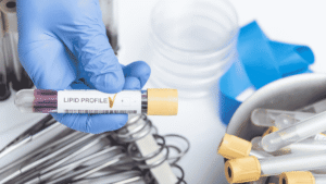 How a Lipid Profile Test Helps Monitor Heart Health