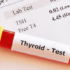 Thyroid Test Understanding Your Thyroid Health and Hormone Levels