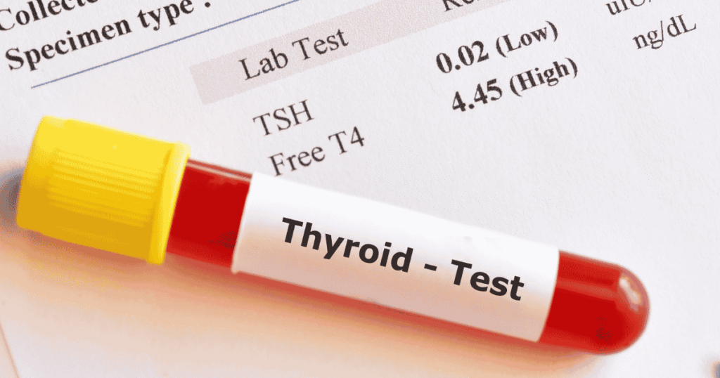 Thyroid Test Understanding Your Thyroid Health and Hormone Levels