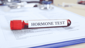 Why Hormone Tests Are Important for Your Overall Health