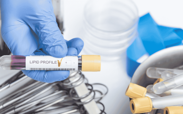 How a Lipid Profile Test Helps Monitor Heart Health