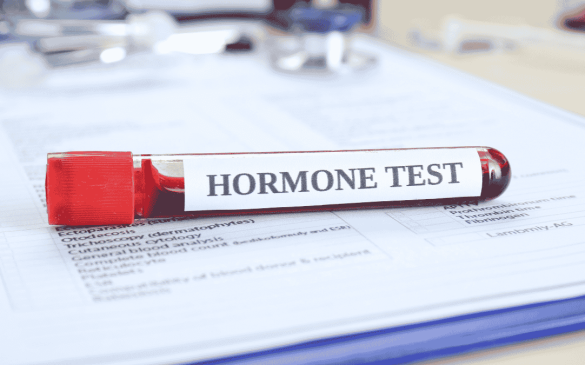 Why Hormone Tests Are Important for Your Overall Health